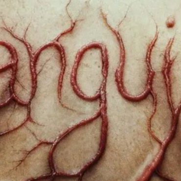 Sanguine